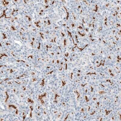 Immunohistochemistry-Paraffin: CFTR Antibody [NBP1-89315]
