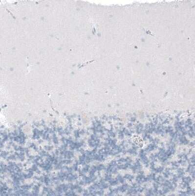 Immunohistochemistry-Paraffin: CFTR Antibody [NBP1-89315]
