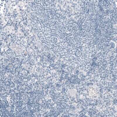Immunohistochemistry-Paraffin: CFTR Antibody [NBP1-89315]