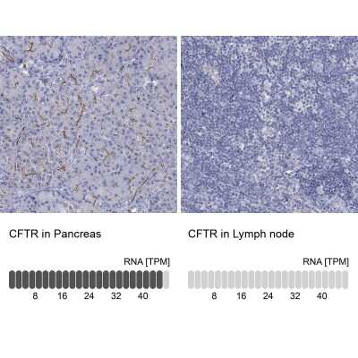 Immunohistochemistry-Paraffin: CFTR Antibody [NBP3-16990]