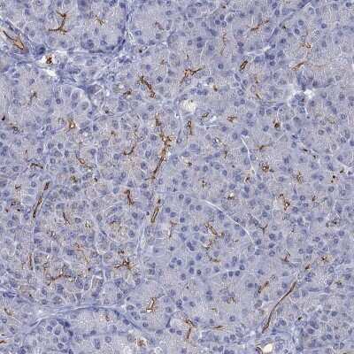 Immunohistochemistry-Paraffin: CFTR Antibody [NBP3-16990]