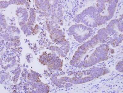 Immunohistochemistry-Paraffin: CG1458 Antibody [NBP2-42827]