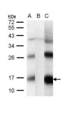 Western Blot: CG1458 Antibody [NBP2-42827]