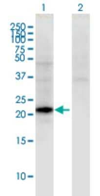 Western Blot: CGB5 Antibody (2E7) [H00093659-M02]