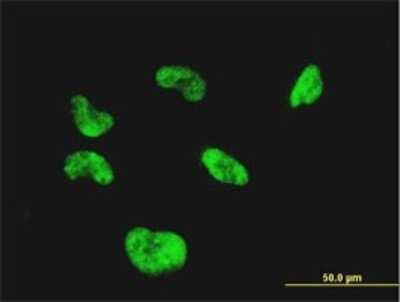 Immunocytochemistry/ Immunofluorescence: CGGBP1 Antibody (1D11) [H00008545-M02]