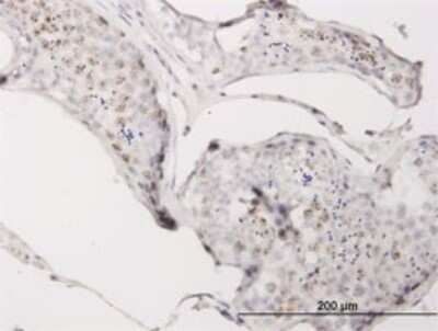 Immunohistochemistry-Paraffin: CGGBP1 Antibody (1D11) [H00008545-M02]