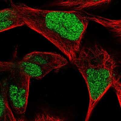Immunocytochemistry/ Immunofluorescence: CGGBP1 Antibody [NBP2-32680]