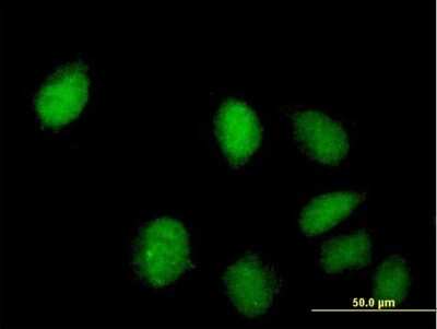 Immunocytochemistry/ Immunofluorescence: CGI 62 Antibody [H00051101-B01P]