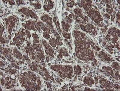 Immunohistochemistry: CGI 62 Antibody (OTI4C1) - Azide and BSA Free [NBP2-71896]
