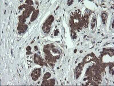 Immunohistochemistry: CGI 62 Antibody (OTI4C1) - Azide and BSA Free [NBP2-71896]