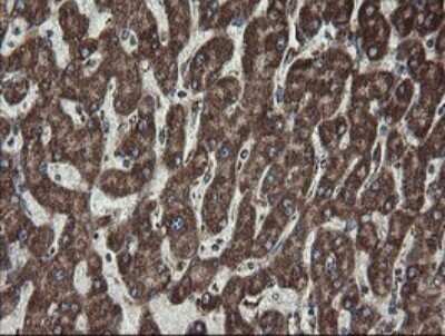 Immunohistochemistry: CGI 62 Antibody (OTI4C1) - Azide and BSA Free [NBP2-71896]