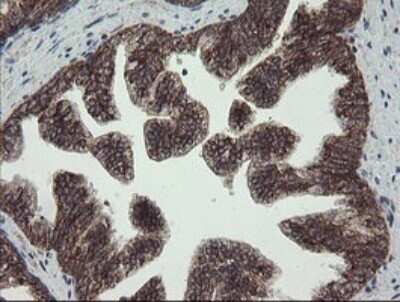 Immunohistochemistry: CGI 62 Antibody (OTI4C1) - Azide and BSA Free [NBP2-71896]