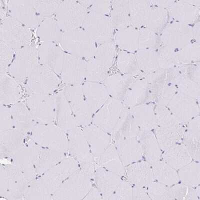 Immunohistochemistry-Paraffin: CGNL1 Antibody [NBP2-37959]