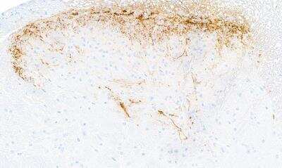 Immunohistochemistry: CGRP1 Antibody (BLR159J) [NBP3-14734]