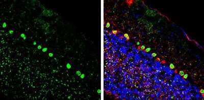 Immunohistochemistry-Frozen: CGRP1 Antibody [NBP3-13330]