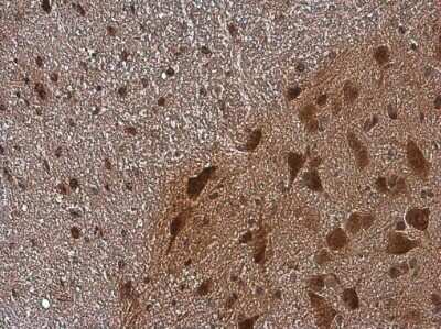 Immunohistochemistry-Paraffin: CGRP1 Antibody [NBP3-13330]