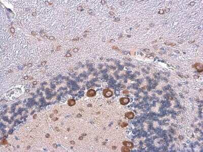 Immunohistochemistry-Paraffin: CGRP1 Antibody [NBP3-13330]