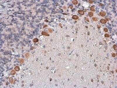 Immunohistochemistry-Paraffin: CGRP1 Antibody [NBP3-13330]