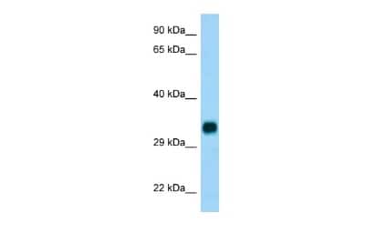 Western Blot: CH25H Antibody [NBP2-83971]