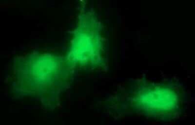 Immunocytochemistry/ Immunofluorescence: CHAC1 Antibody (OTI1E2) - Azide and BSA Free [NBP2-72191]