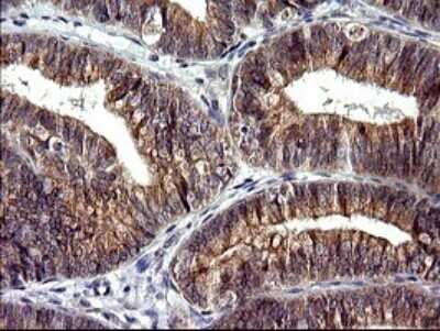 Immunohistochemistry: CHAC1 Antibody (OTI1E2) - Azide and BSA Free [NBP2-72191]
