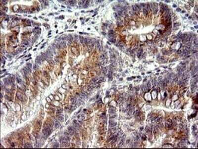 Immunohistochemistry: CHAC1 Antibody (OTI1E2) - Azide and BSA Free [NBP2-72191]
