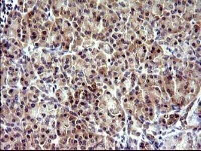 Immunohistochemistry: CHAC1 Antibody (OTI1E2) - Azide and BSA Free [NBP2-72191]