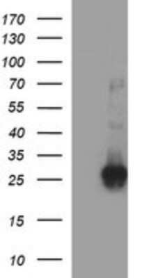 Western Blot: CHAC1 Antibody (OTI1E2) [NBP2-46273]