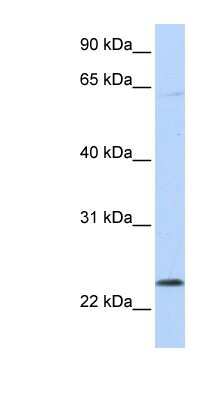 Western Blot: CHAC1 Antibody [NBP1-57685]