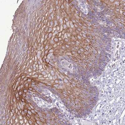 Immunohistochemistry-Paraffin: CHAC2 Antibody [NBP2-14476]