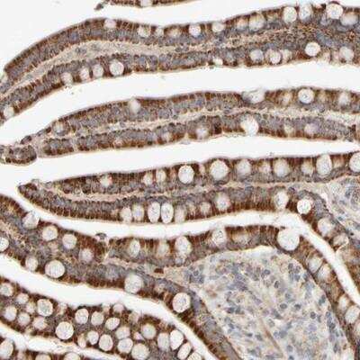 Immunohistochemistry: CHADL Antibody [NBP1-90662]
