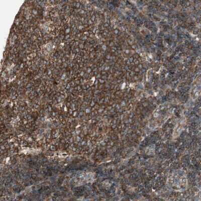 Immunohistochemistry-Paraffin: CHADL Antibody [NBP1-90663]