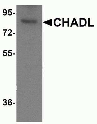 Western Blot: CHADL AntibodyBSA Free [NBP2-81906]