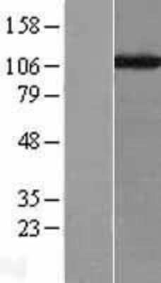 Western Blot: CHAF1A Overexpression Lysate [NBL1-09139]