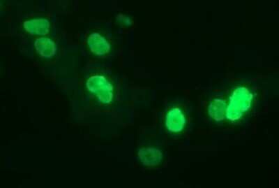 Immunofluorescence: CHAF1B Antibody (OTI4F7) [NBP2-46274]
