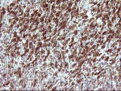 Immunohistochemistry: CHAF1B Antibody (OTI4F7) [NBP2-46274]