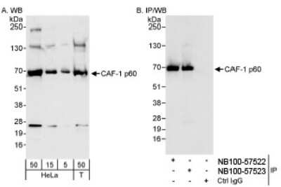 Western Blot: CHAF1B Antibody [NB100-57523]