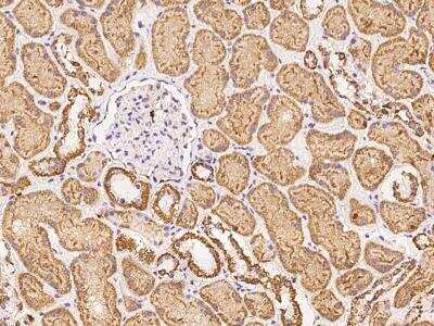 Immunohistochemistry-Paraffin: CHCHD1 Antibody [NBP3-06218]