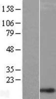 Western Blot: CHCHD1 Overexpression Lysate [NBL1-09141]