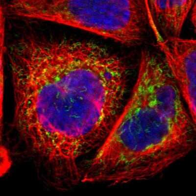 Immunocytochemistry/ Immunofluorescence: CHCHD10 Antibody [NBP1-91169]