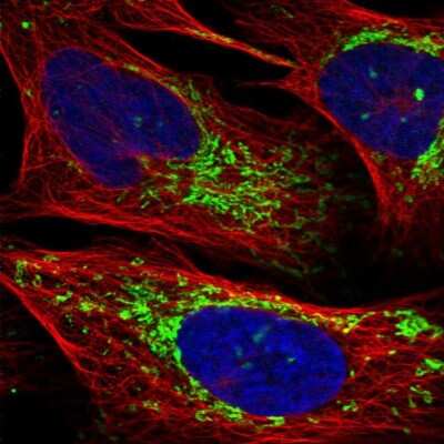 Immunocytochemistry/ Immunofluorescence: CHCHD2 Antibody [NBP1-94106]
