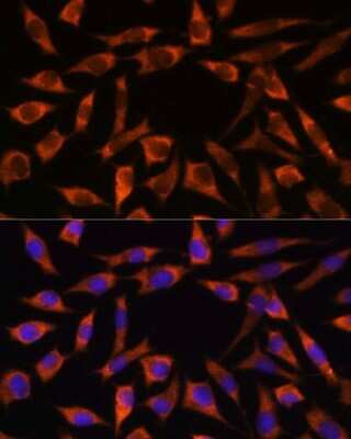 Immunocytochemistry/ Immunofluorescence: CHCHD2 Antibody - Azide and BSA Free [NBP2-92335]