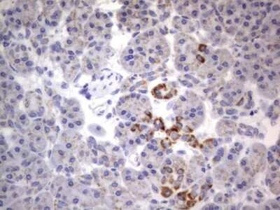 Immunohistochemistry: CHCHD3 Antibody (OTI7G4) [NBP2-46281]