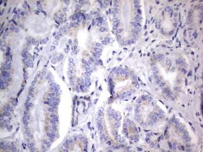 Immunohistochemistry: CHCHD3 Antibody (OTI7G4) [NBP2-46281]