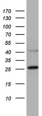 Western Blot: CHCHD3 Antibody (OTI7G4) [NBP2-46281]