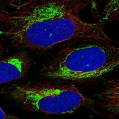 Immunocytochemistry/ Immunofluorescence: CHCHD3 Antibody [NBP1-83656]