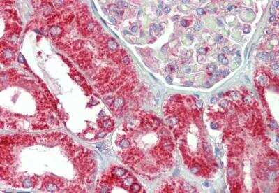 Immunohistochemistry-Paraffin: CHCHD3 Antibody [NBP1-52009]