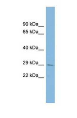 Western Blot: CHCHD3 Antibody [NBP1-56871]