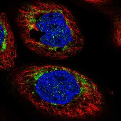 Immunocytochemistry/ Immunofluorescence: CHCHD6 Antibody [NBP1-91779]