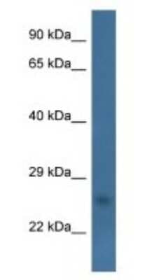 Western Blot: CHCHD6 Antibody [NBP1-79820]